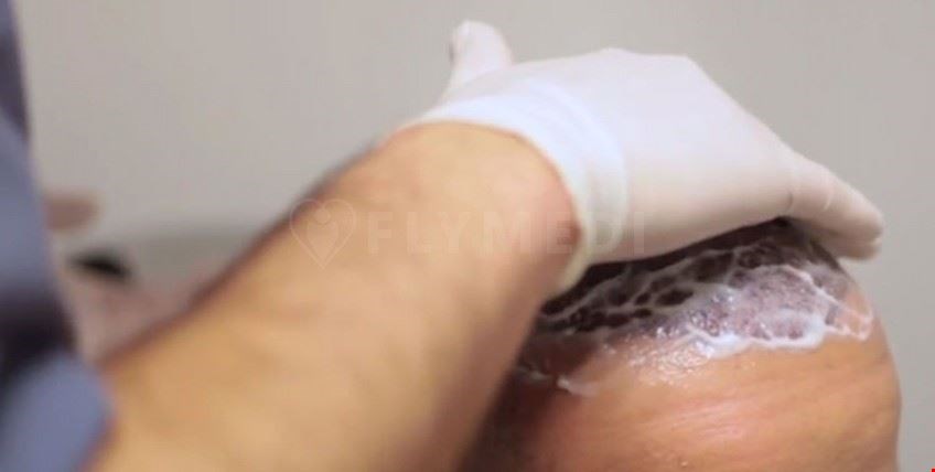 Клиника Istanbul Hair Center 2