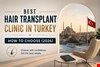 Best Hair Transplant Clinic in Turkey: How to Choose (2026)