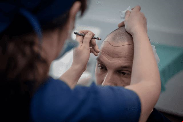 HairPalace Hair Transplant Clinic 1