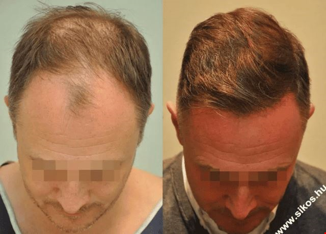Sikos Clinic 2